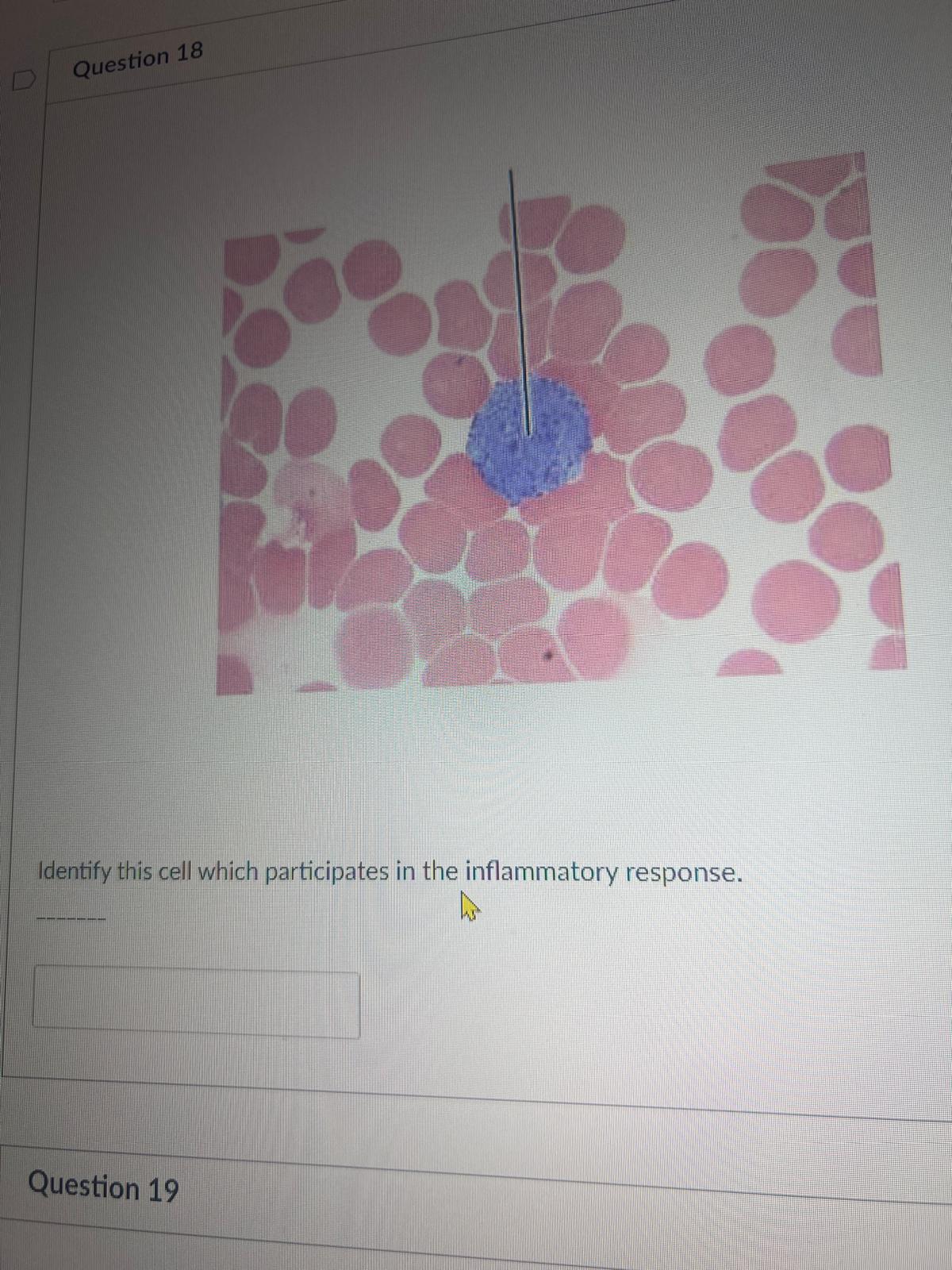 <p><span>Identify this cell which participates in the inflammatory response.</span></p>