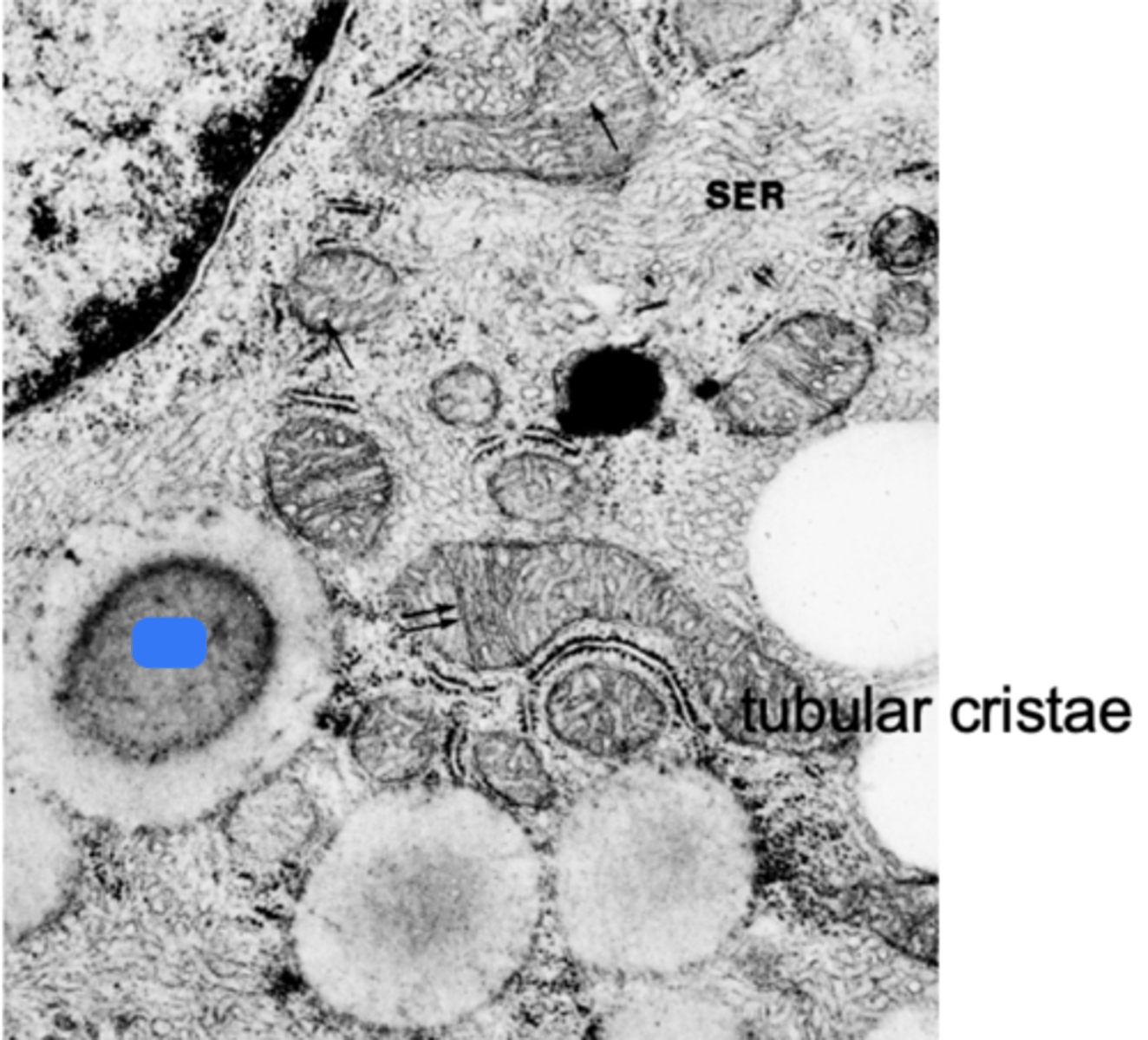 <p>ID the cell in blue:</p>