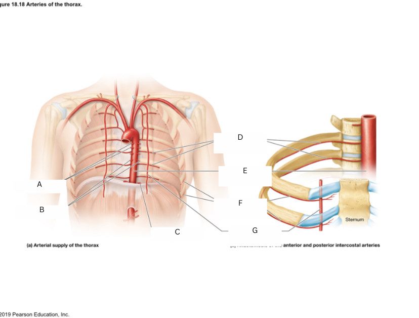 <p>descending thoracic aorta</p>