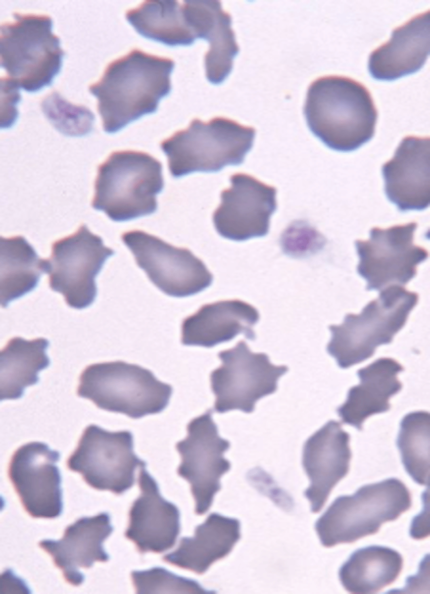 <p>describe the rbc</p>