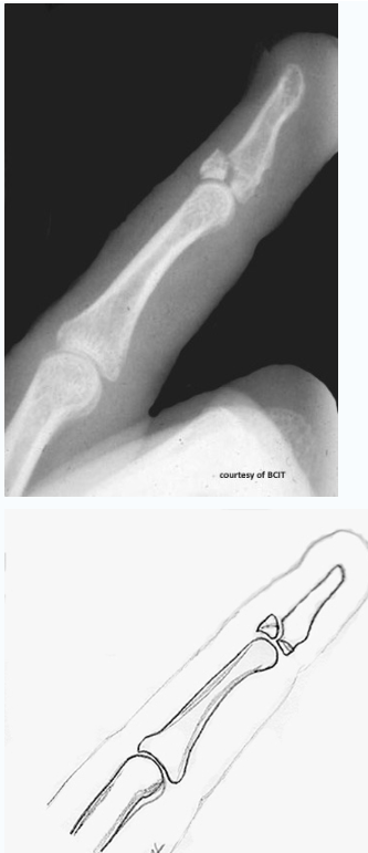<p>which type</p>