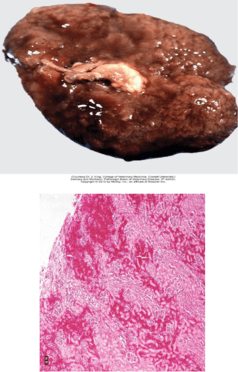 <p>Clostridium perfringens Type D</p><p>Produces epsilon toxin in small ruminants</p><p>Toxic damage causes tubular degeneration &amp; necrosis with interstitial edema &amp; hemorrhage</p><p>*Need to conduct rapid post mortem (autolysis can obscure lesions)*</p>