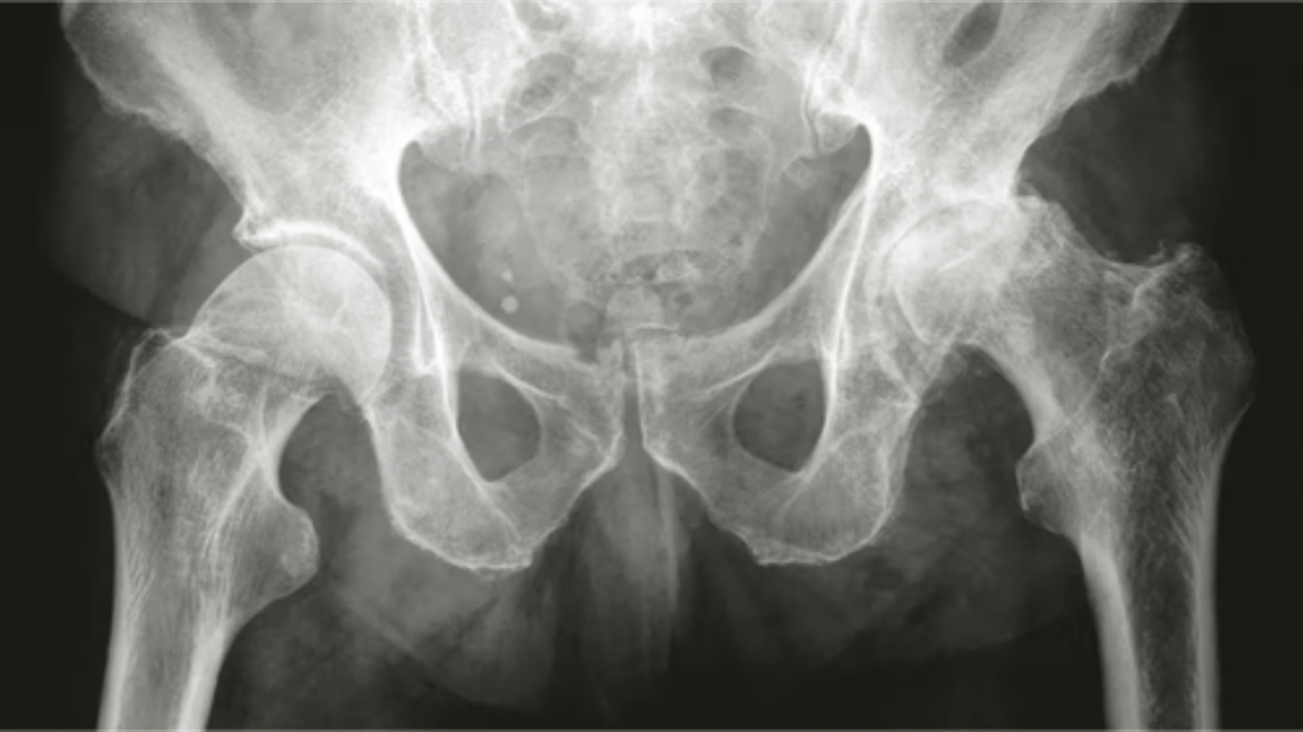 <p>what does this x-ray show</p>