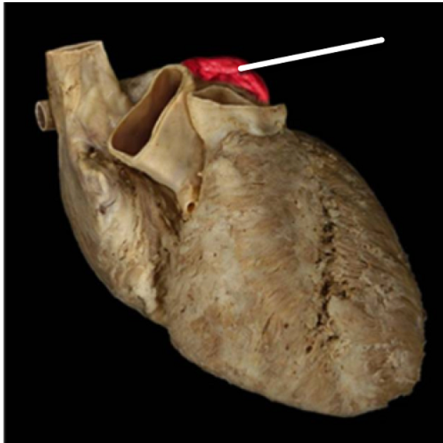 <ul><li><p>right auricle</p></li><li><p>right ventricle</p></li><li><p>superior vena cava</p></li><li><p>left auricle</p></li></ul><p></p>