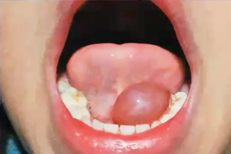 <p>what is the diagnosis </p>