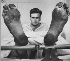 the trenches were constantly wet and muddy and this caused the feet to rot and sometimes require amputation