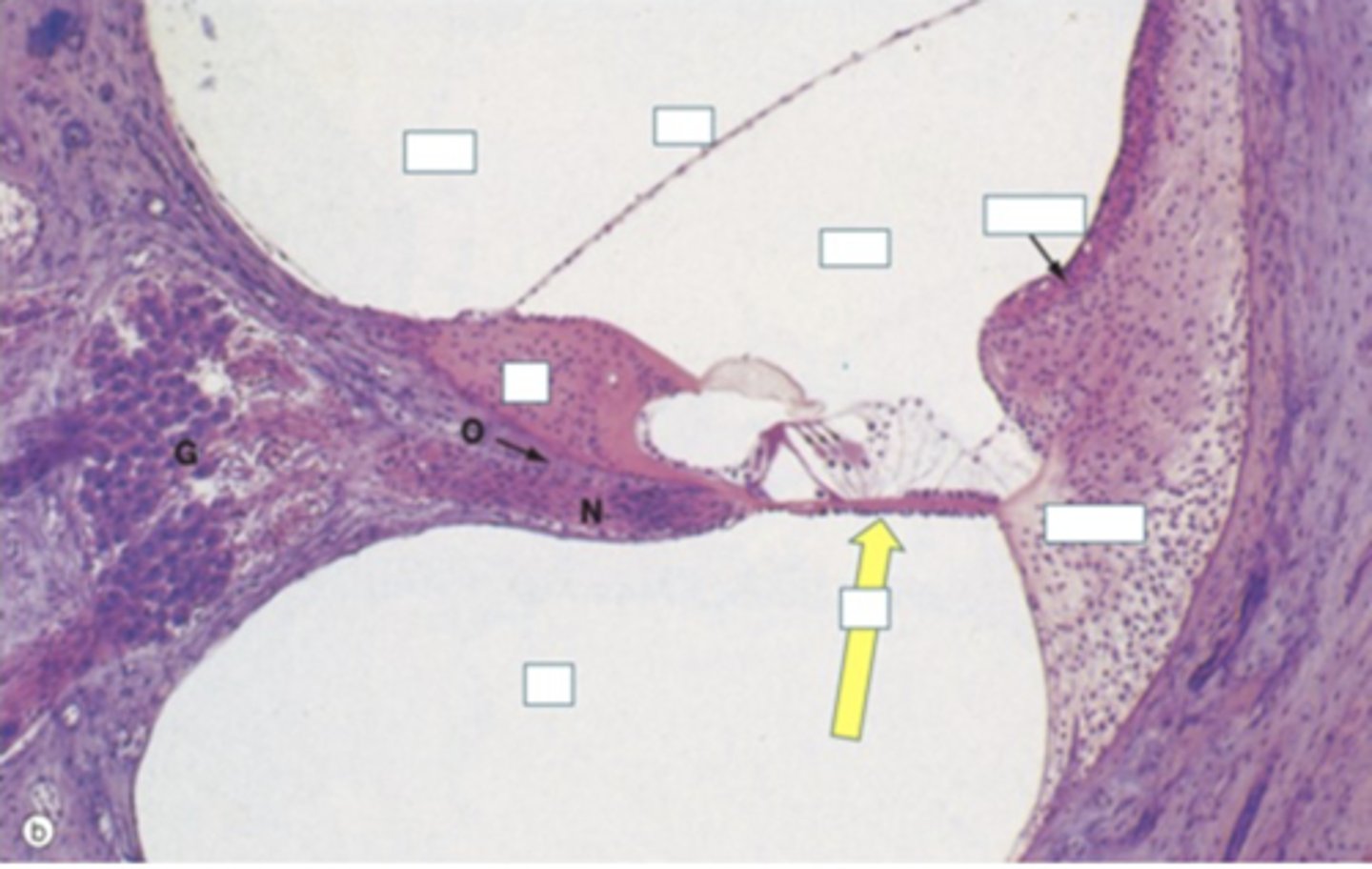 <p>Identify the structure</p>