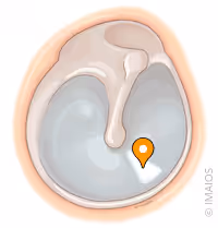 <p>what part of the ear is this</p>