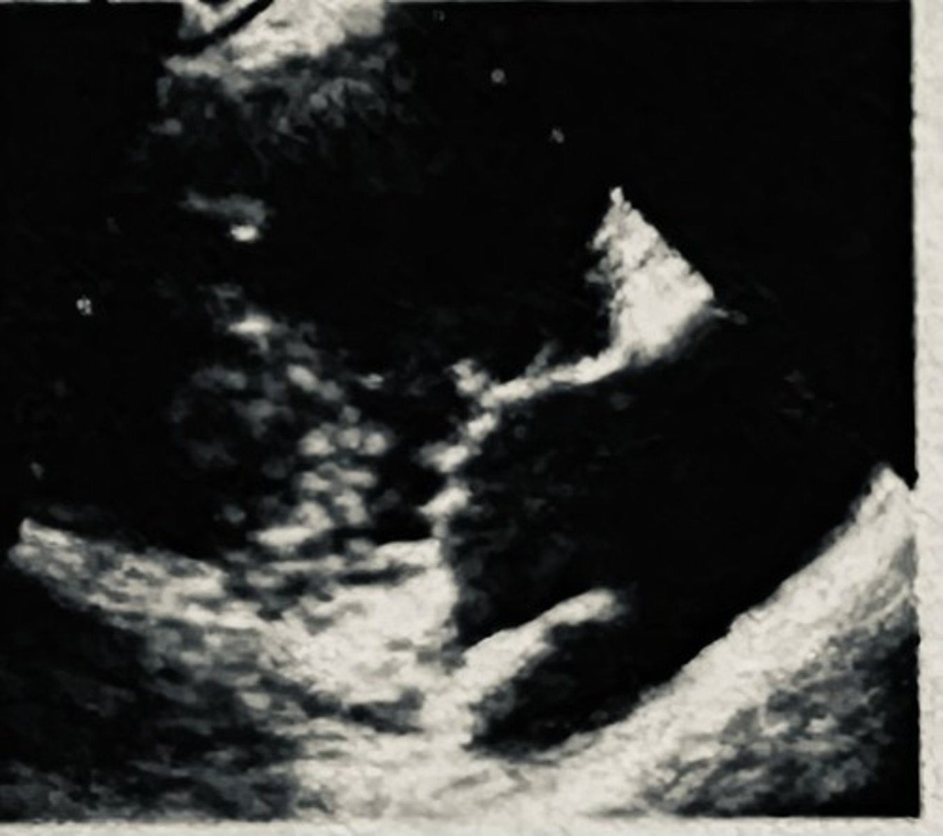 <p></p>