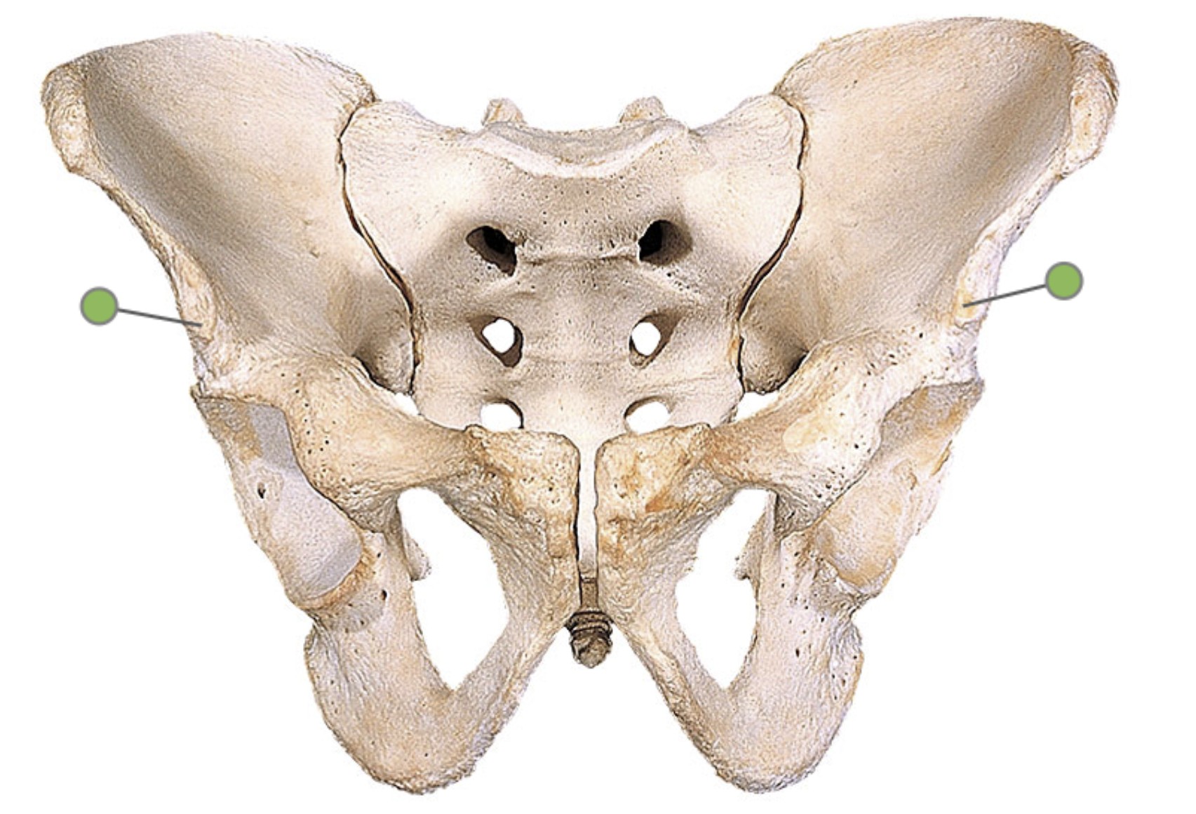 <p>Which bone landmark of pelvic girdle is a bony prominence inferior to the ASIS?</p>