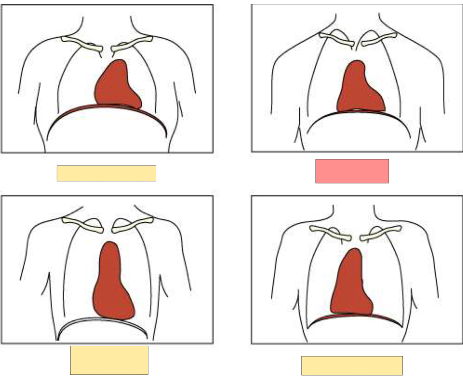 <p>What body habitus is this?</p>