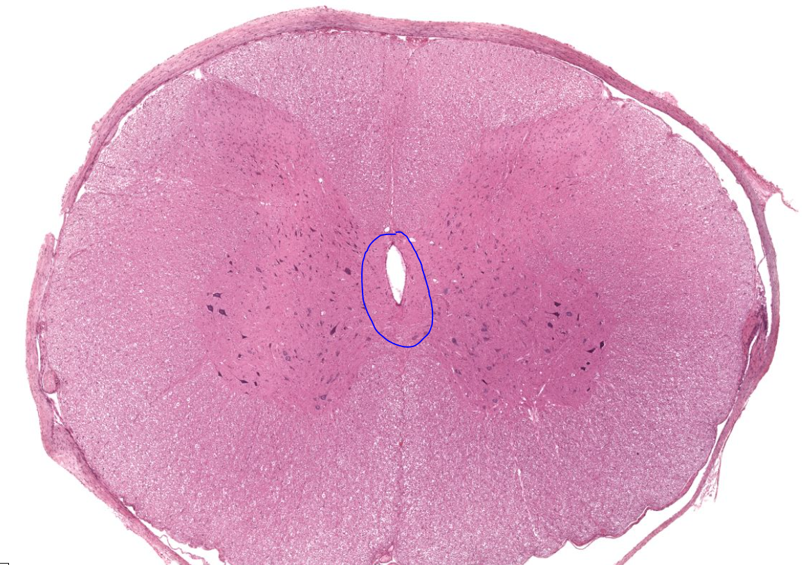 <p>small round hole in center of the spinal cord that contains csf. lined with simple cuboidal </p>