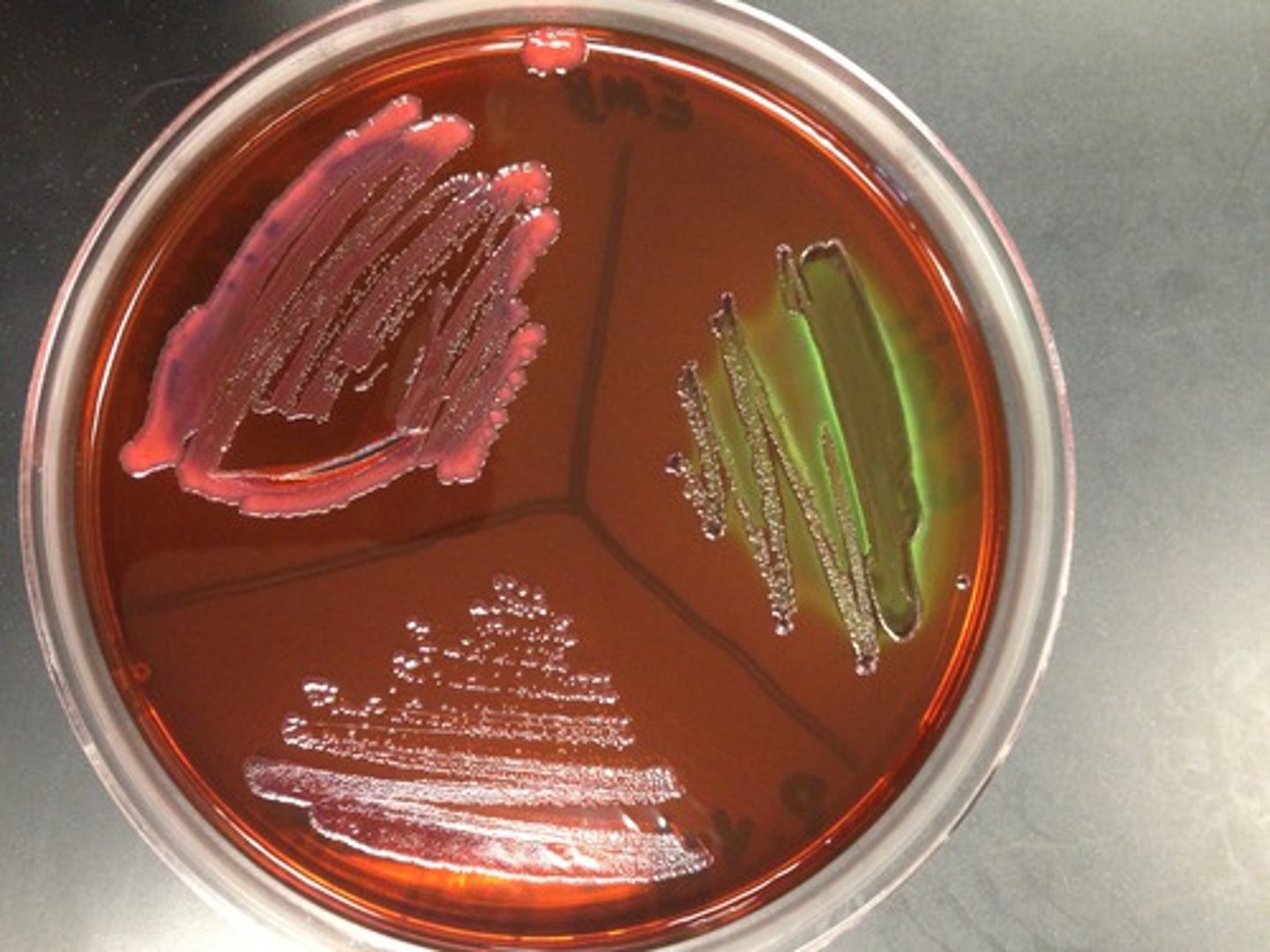 <p>- distinguish colonies of bacteria by color change</p>