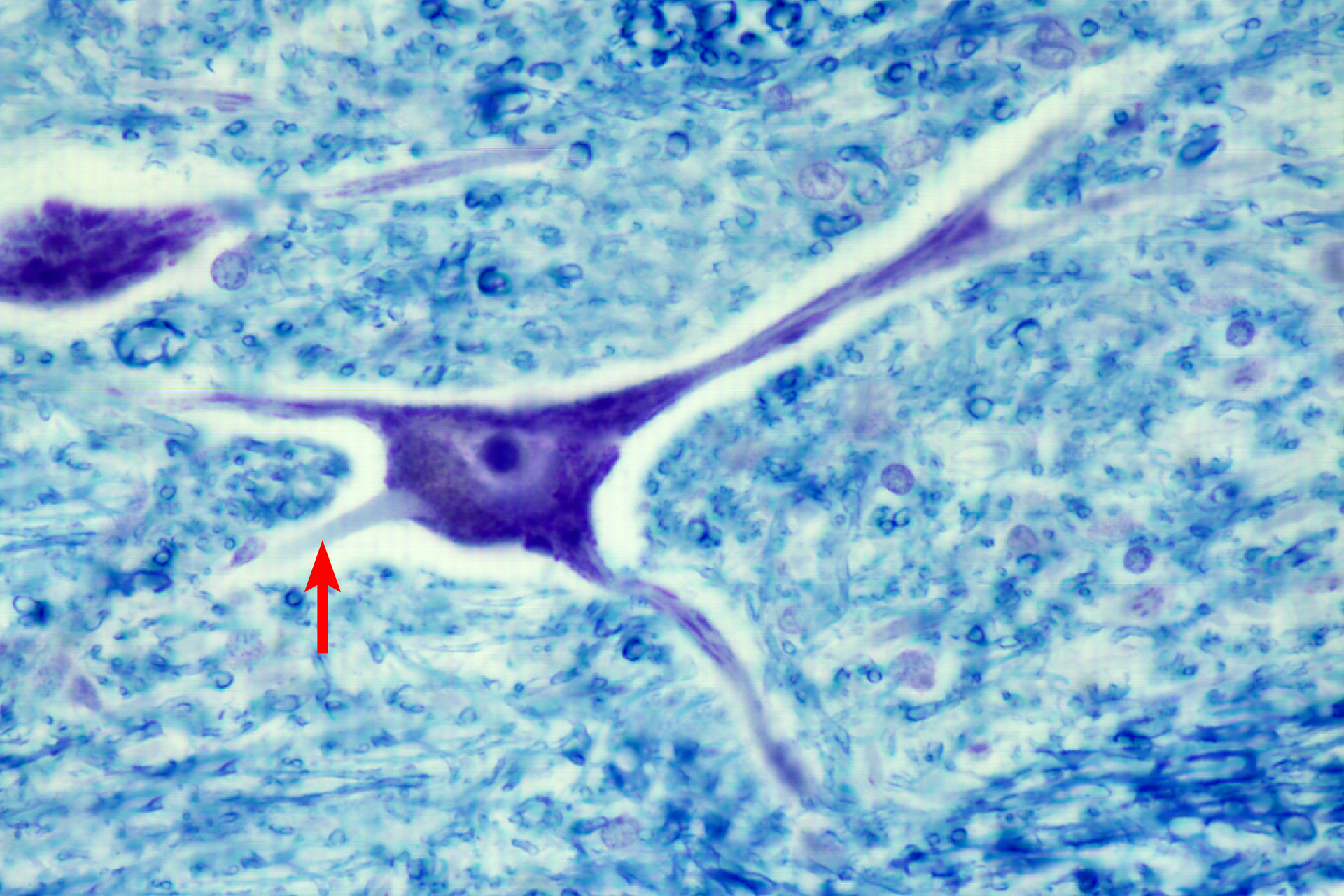 <p>Axon</p>