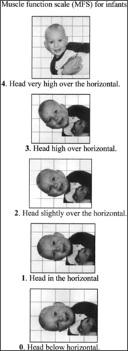 <p>head high over horizontal line and >45 degrees</p>