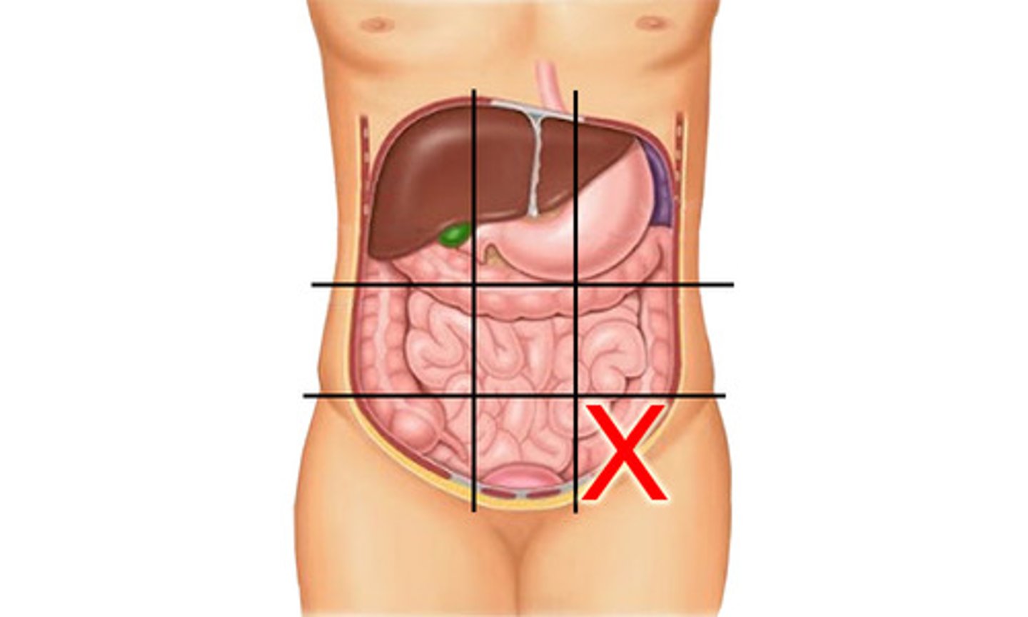 knowt flashcard image