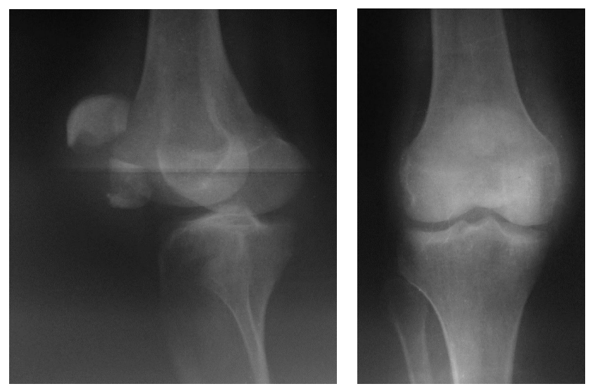 <p>This X-ray image shows a lateral and anterior view of what?</p>