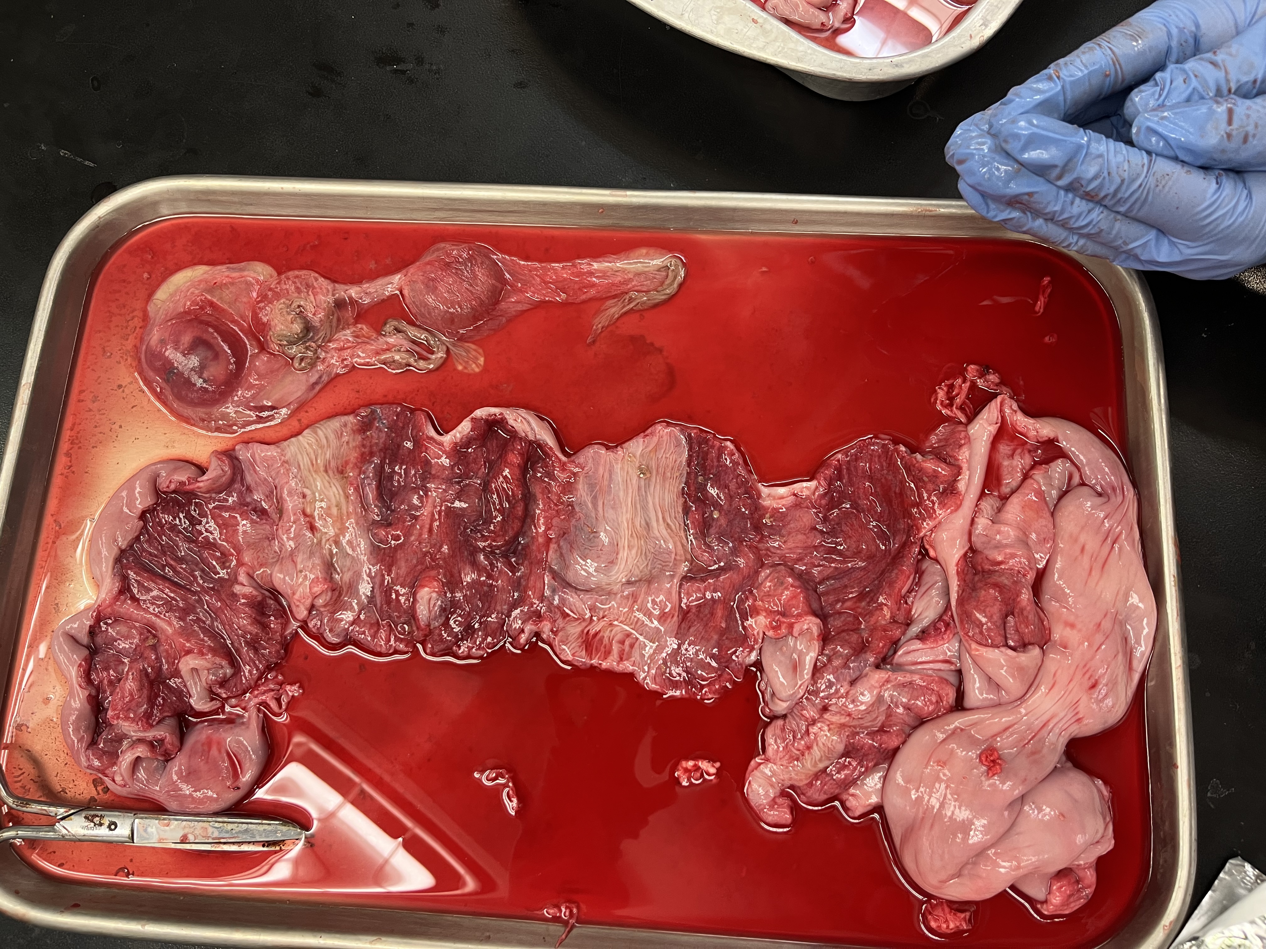 <p>What is the light pink / white tissue?</p>