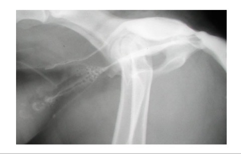 <p>F SA urethra- where does it enter vestibule </p>