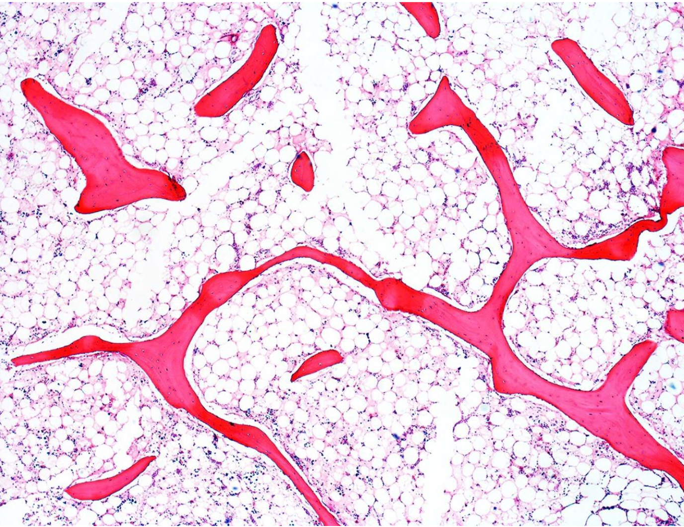 <p>ruminants, weeks, bone marrow depression (affecting PLT, WBC, RBCs) </p><p>North America</p>
