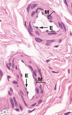 <ul><li><p>Contains 1 - 2 layers of smooth muscle cells</p></li><li><p>Elastic fibers limited to internal elastic lamina (IEL)</p></li><li><p>No external elastic lamina (EEL)</p></li><li><p>The transition from large to small arterioles is indicated by the loss of IEL</p></li><li><p><em>Tunica adventitia </em>is very thin</p></li><li><p>E, endothelium</p></li><li><p>M, <em>tunica media</em></p></li></ul><p></p>