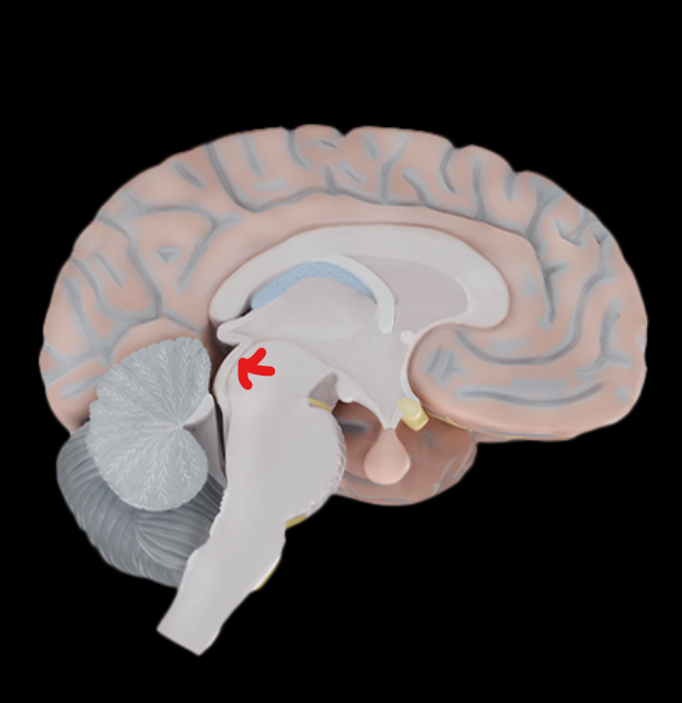 term image