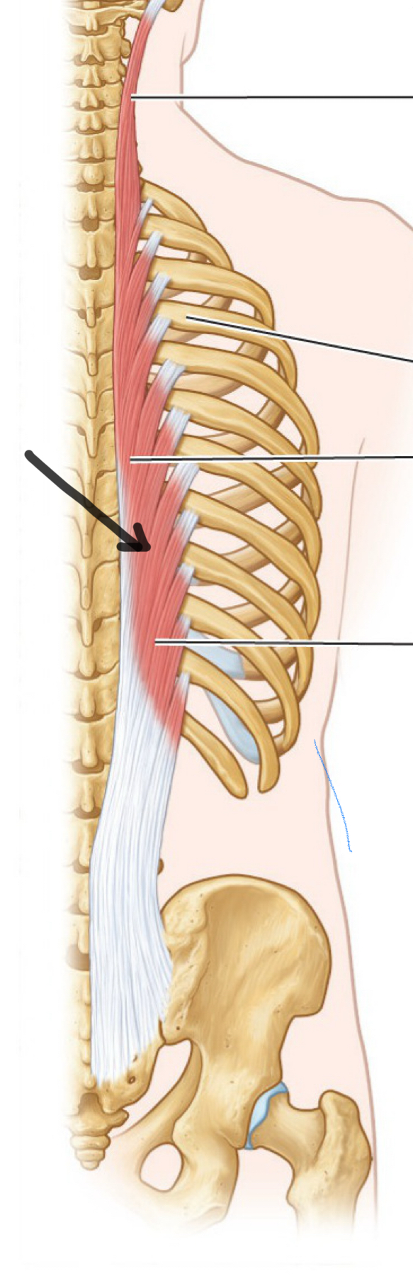 <p>What mm?</p><p>O, I, A bilateral and unilateral</p>