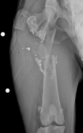 <p><span>The different classification of open fractures&nbsp;are Type I, II, IIIa, IIIb, and IIIc.&nbsp;</span><br><br><span>They are classified&nbsp;based on the mechanism of injury, degree of soft tissue damage, configuration of the fracture, and the degree of contamination.</span></p>