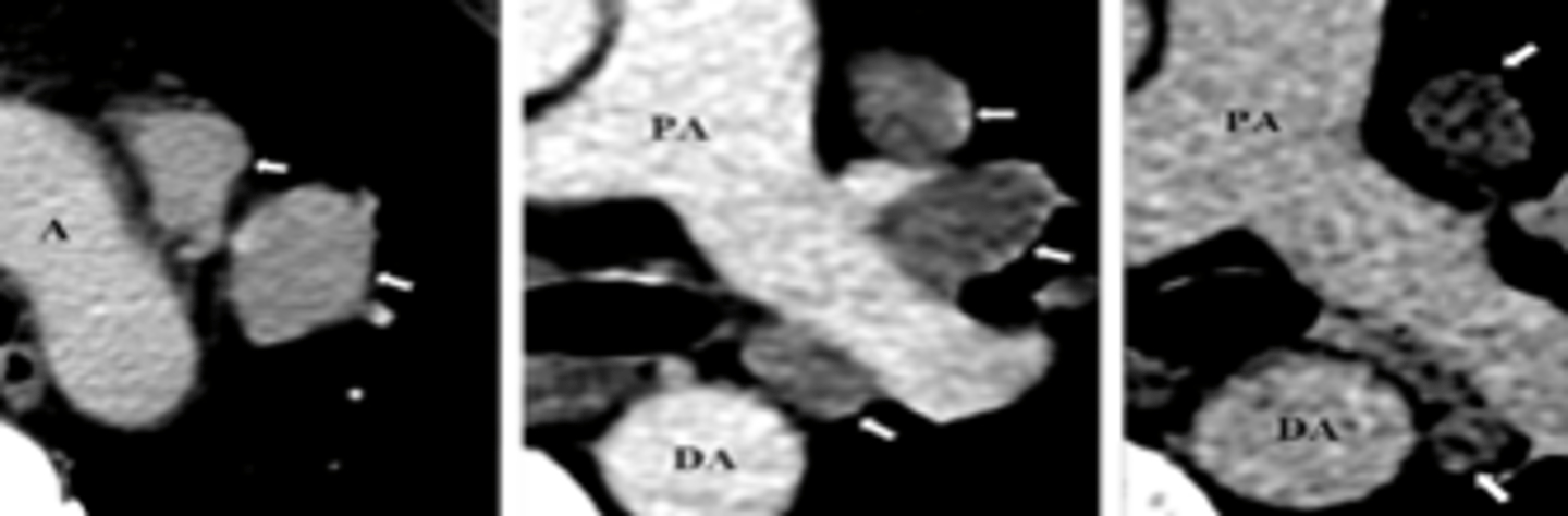 <p>cluster of black pearl signs</p>