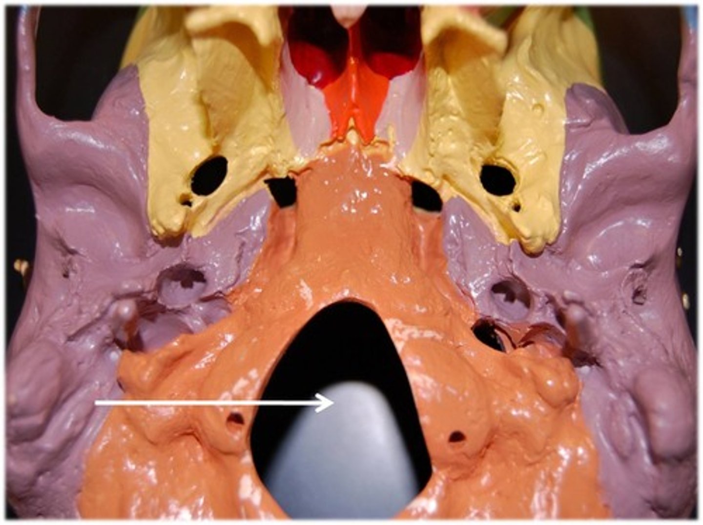<p>for spinal cord</p>