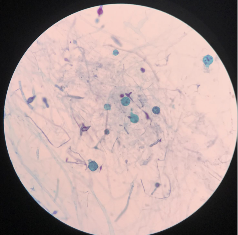 <p>Belongs to oomycetes in stramenopiles clade</p><p>Not a fungus but looks and behaves like one - multicellular - saprobic (parasitic)</p><p>Responsible for Irish potato famine</p><p>Body is a mass of cell width filaments called hyphae</p><p>Multiple nuclei in a single plasma membrane (coenocytes)</p><p>Reproduces via oogonium</p><p>Be able to label hyphae and oogonium</p>