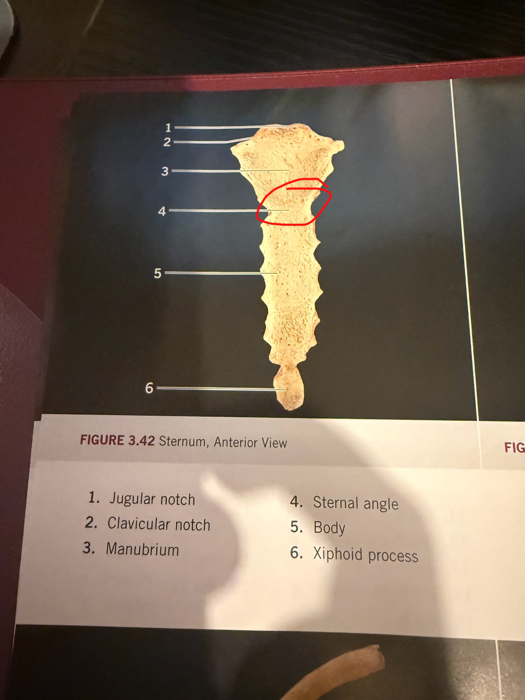 term image