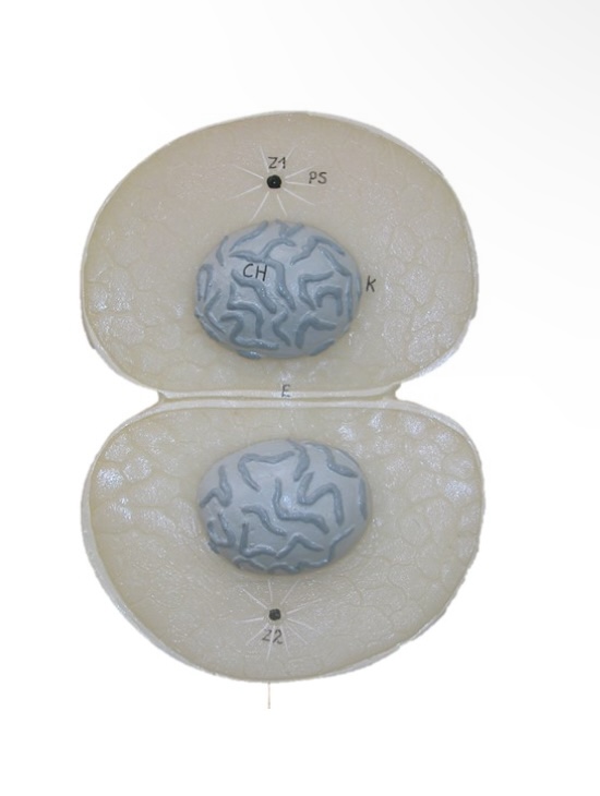 <p>What is this processed called in cell division?</p>