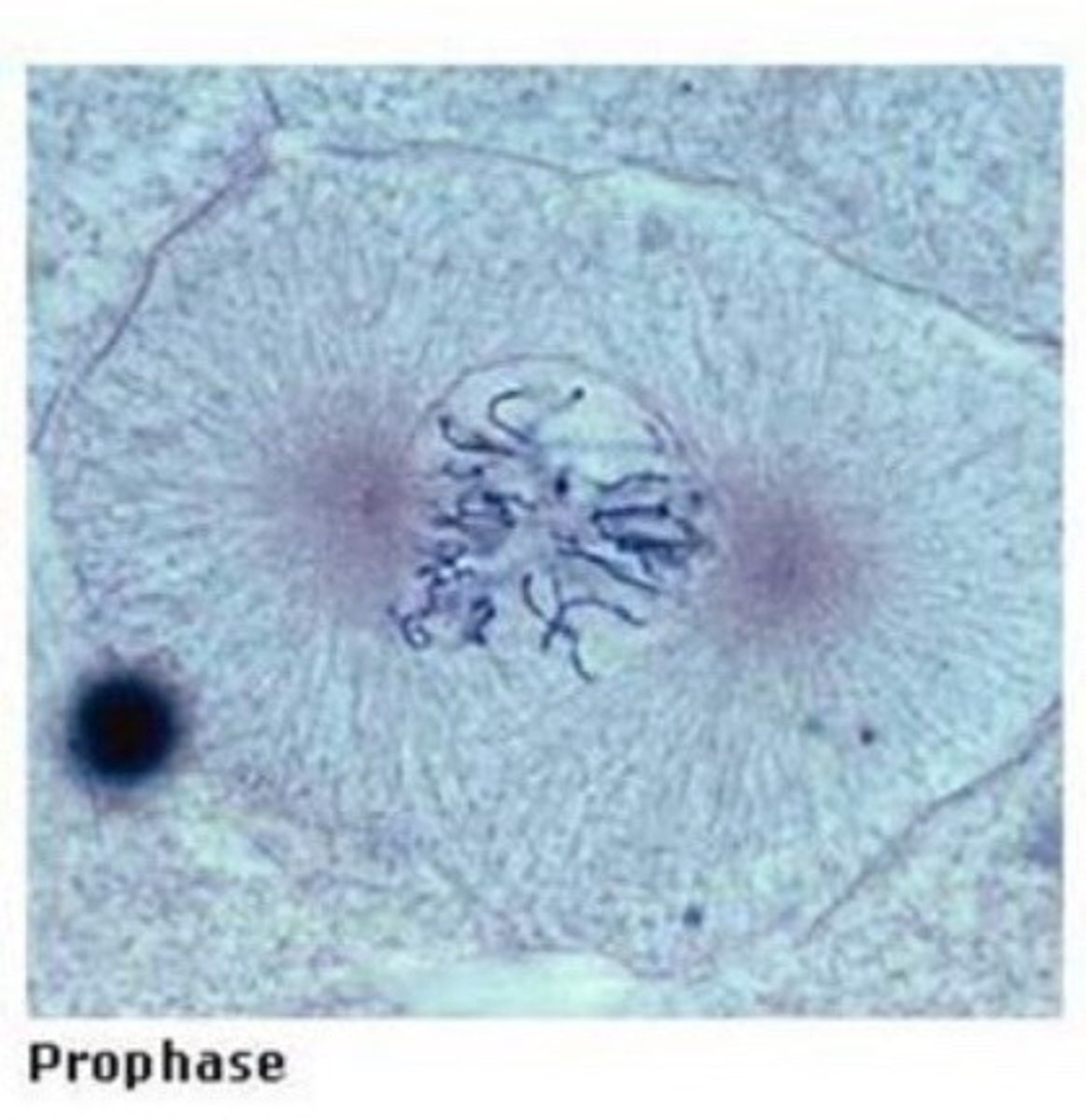 <p>- The nuclear envelope is in the process of disappearing as a spindle apparatus appears. DNA coils tightly to form visible chromosomes which appear rod shaped. The nucleolus disappears. In animal cells, a pair of centrioles (not visible on the slides) separate and with their newly formed asters (visible) move to each pole</p>