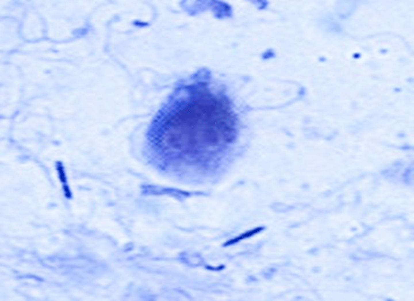 <p>Identify this protozoan of dogs, found on a wet mount fecal smear.</p>