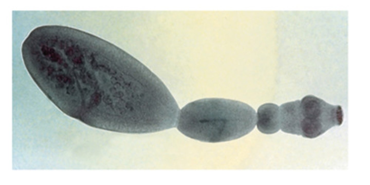 <p>This tapeworm of dogs and cats only has 3 proglottids. What is this tapeworm</p>