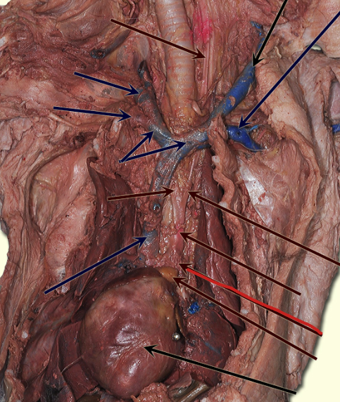 <p>carries oxygenated blood from heart to the rest of the body</p>