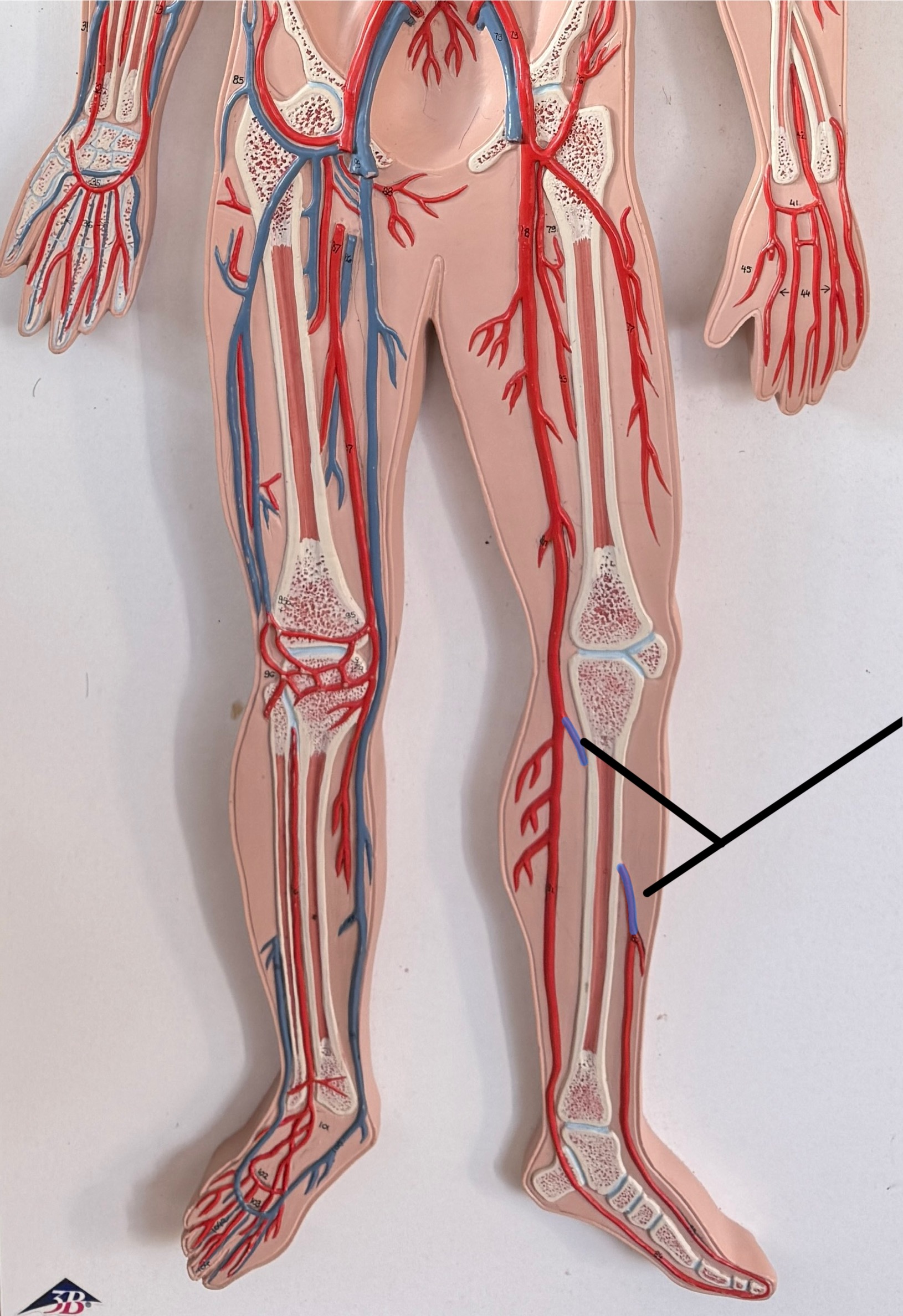 <p>Name this artery.</p>