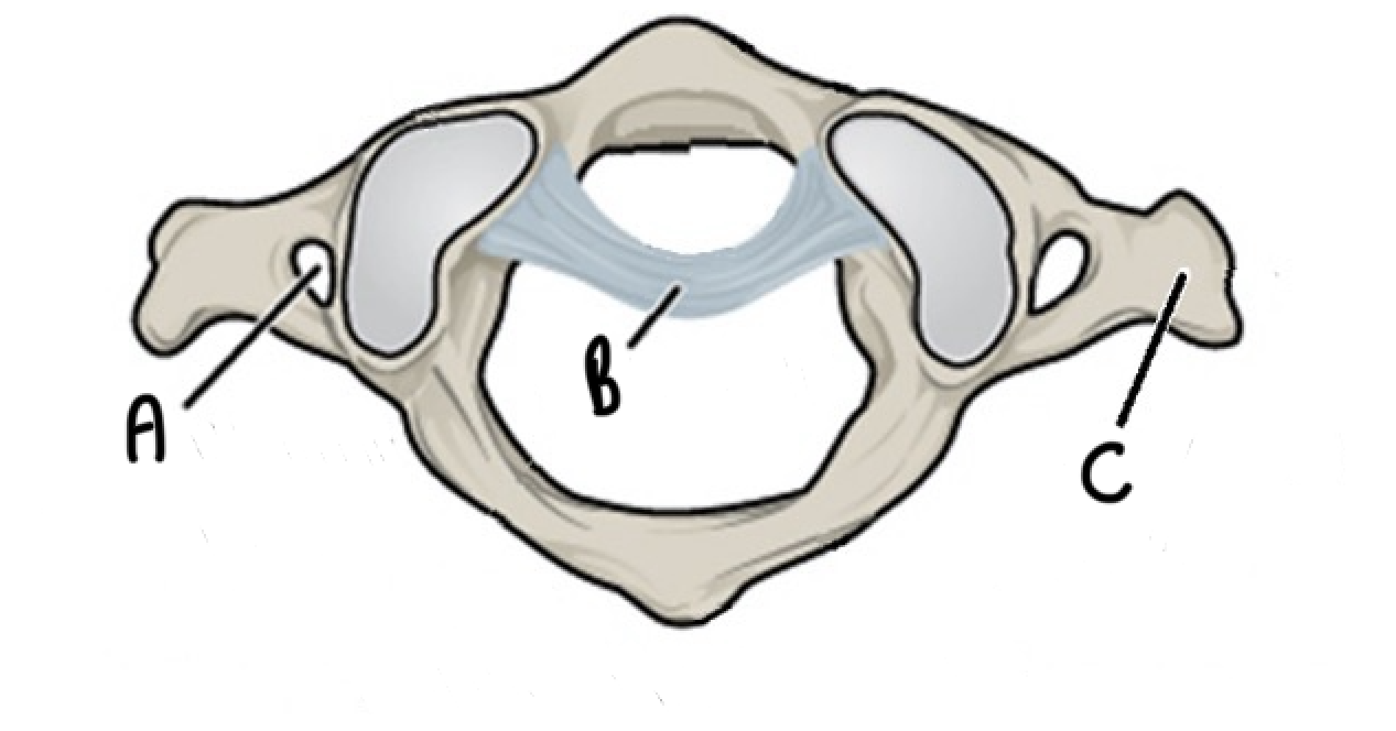 <p>What vertebrae is this and label it</p>