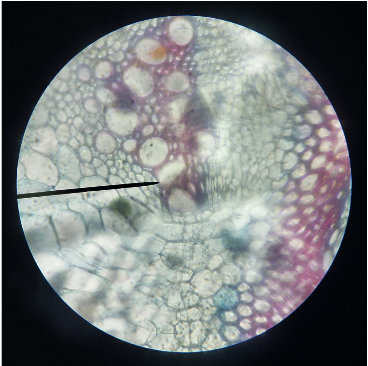 <p>Tissue</p><p></p>
