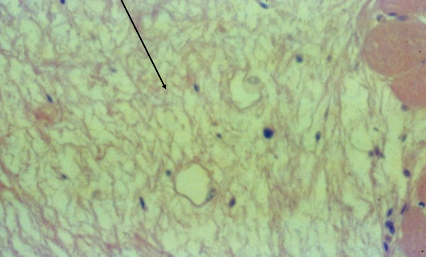 <p>Where is the loose (areolar) connective tissue found?</p>