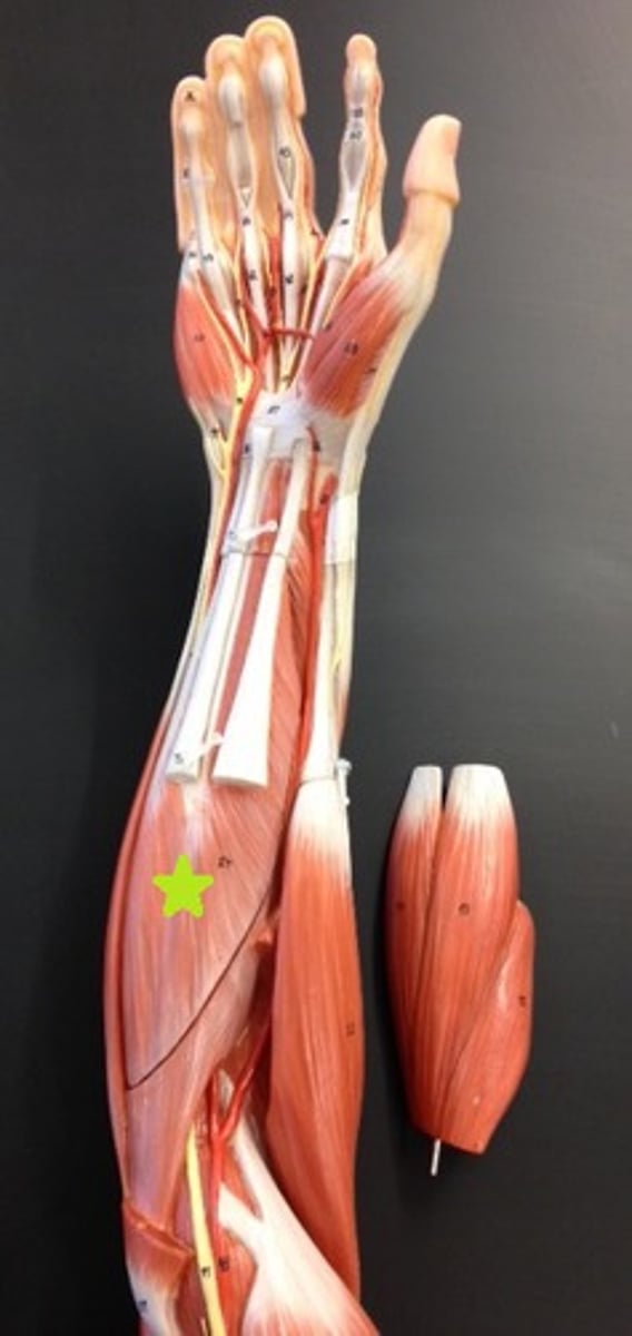 <p>Flexes digits II-V of the hand</p>