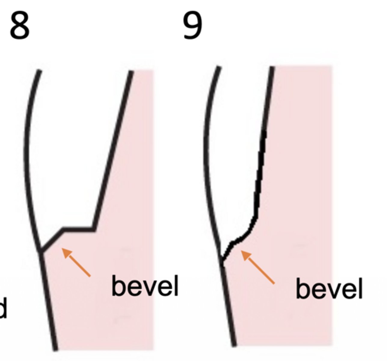 <p>What type of margin design is at 8?</p>
