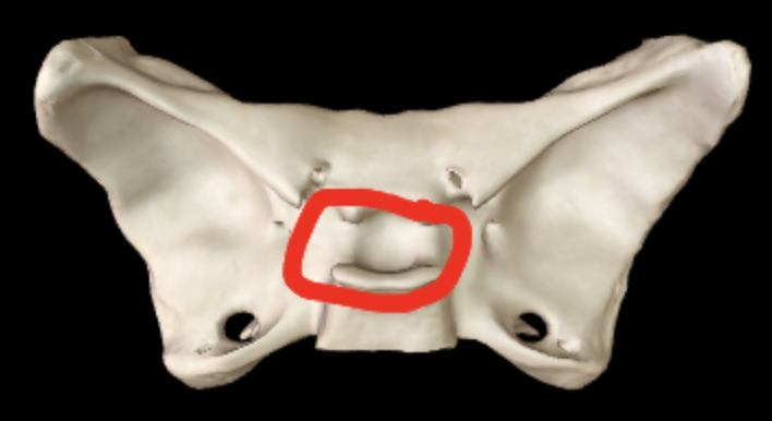 <p>What part of the sphenoid is this?</p>