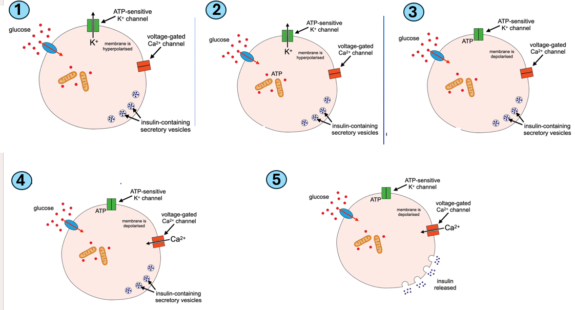 <p>-when blood glucose concentration is high, <strong>glucose enters</strong> the beta cell through the <strong>glucose transporter protein</strong> <strong>(1) </strong>[facilitated diffusion]</p><p>-glucose is <strong>metabolised</strong> in <u>mitochondria</u> to produce <strong>ATP</strong> <strong>(2) </strong>[more glucose→increased respiration]</p><p>-ATP <u>binds to</u><strong><u> potassium ion channels</u></strong>, causing them to <u>close</u> <strong>(3)</strong></p><p>-potassium ions <u>cannot diffuse out</u> of cell</p><p>-the <u>concentration of potassium ions increases</u> inside beta cell</p><p>-plasma membrane becomes <strong>depolarised</strong> (becomes less negative →as theres more positive K+ ions)</p><p>-calcium ion channels <u>open</u> <strong>(4)</strong></p><p>-calcium ions enters the beta cell and causes the <u>vesicles containing insulin to fuse with plasma membrane</u></p><p>-insulin is released by <strong>exocytosis (5)</strong></p>