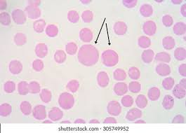 <p>What are these cells exhibiting?</p>