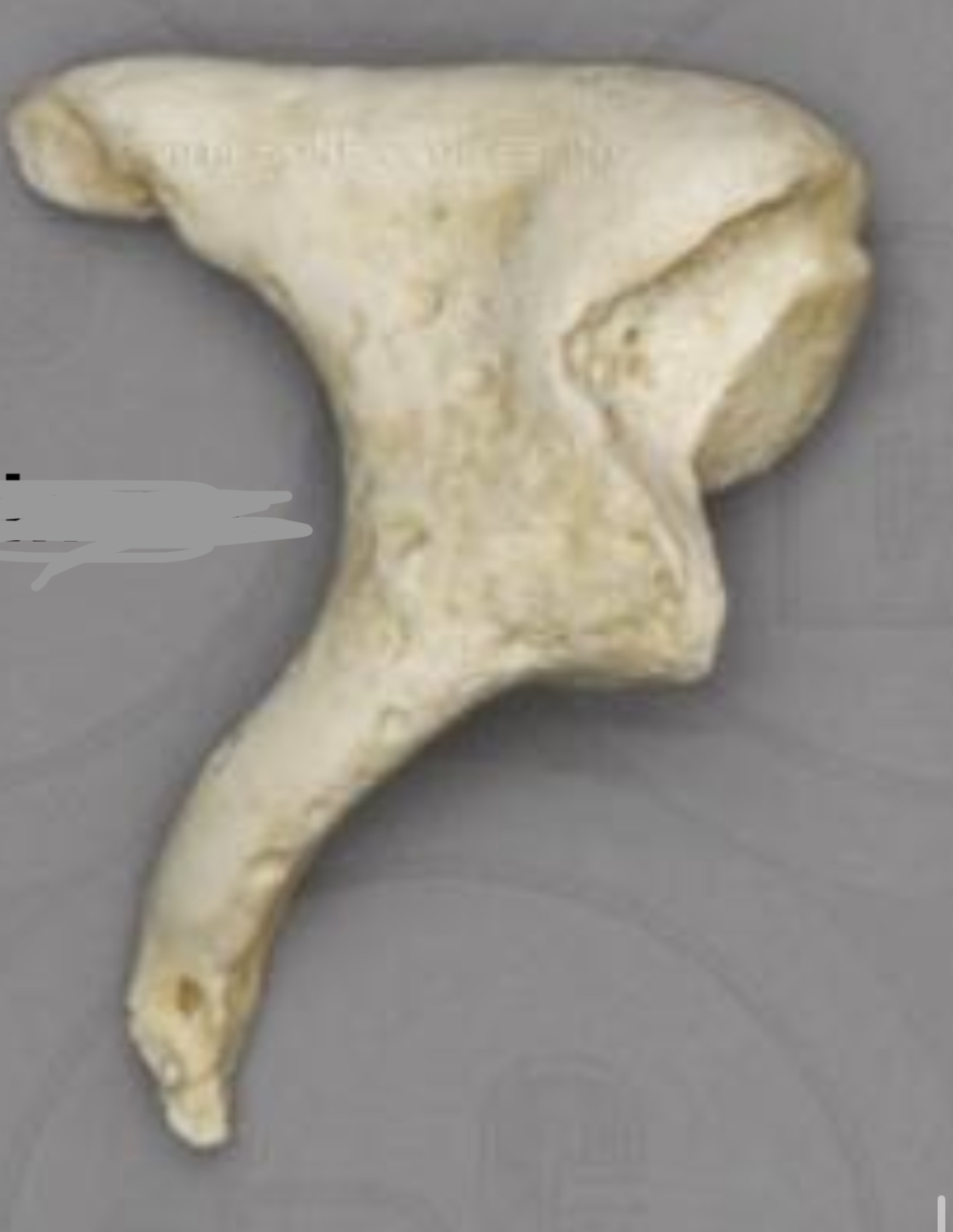 <p>What auditory ossicle is this</p>