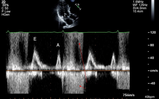 <p>Identify the Spectral Doppler waveform:</p>