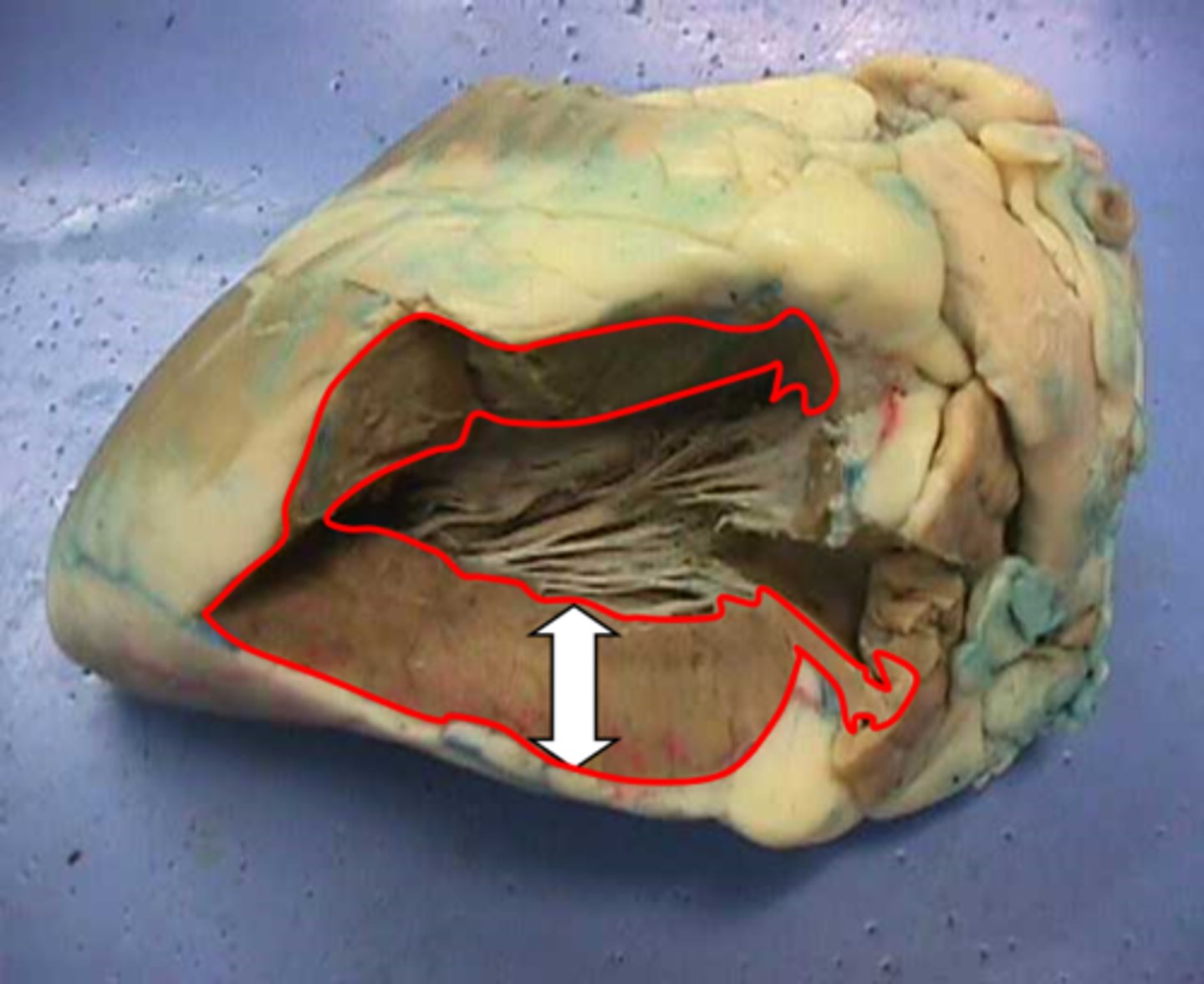 <p>Name this layer.</p>