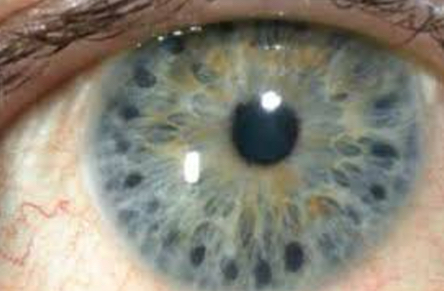 <p>20-25 spots; 2 spot sizes</p>